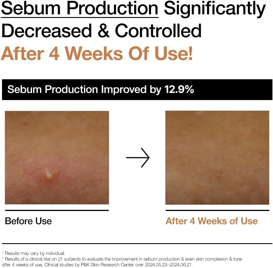 Lotion tonique laiteuse éclat ANUA Rice 70, 250 ml