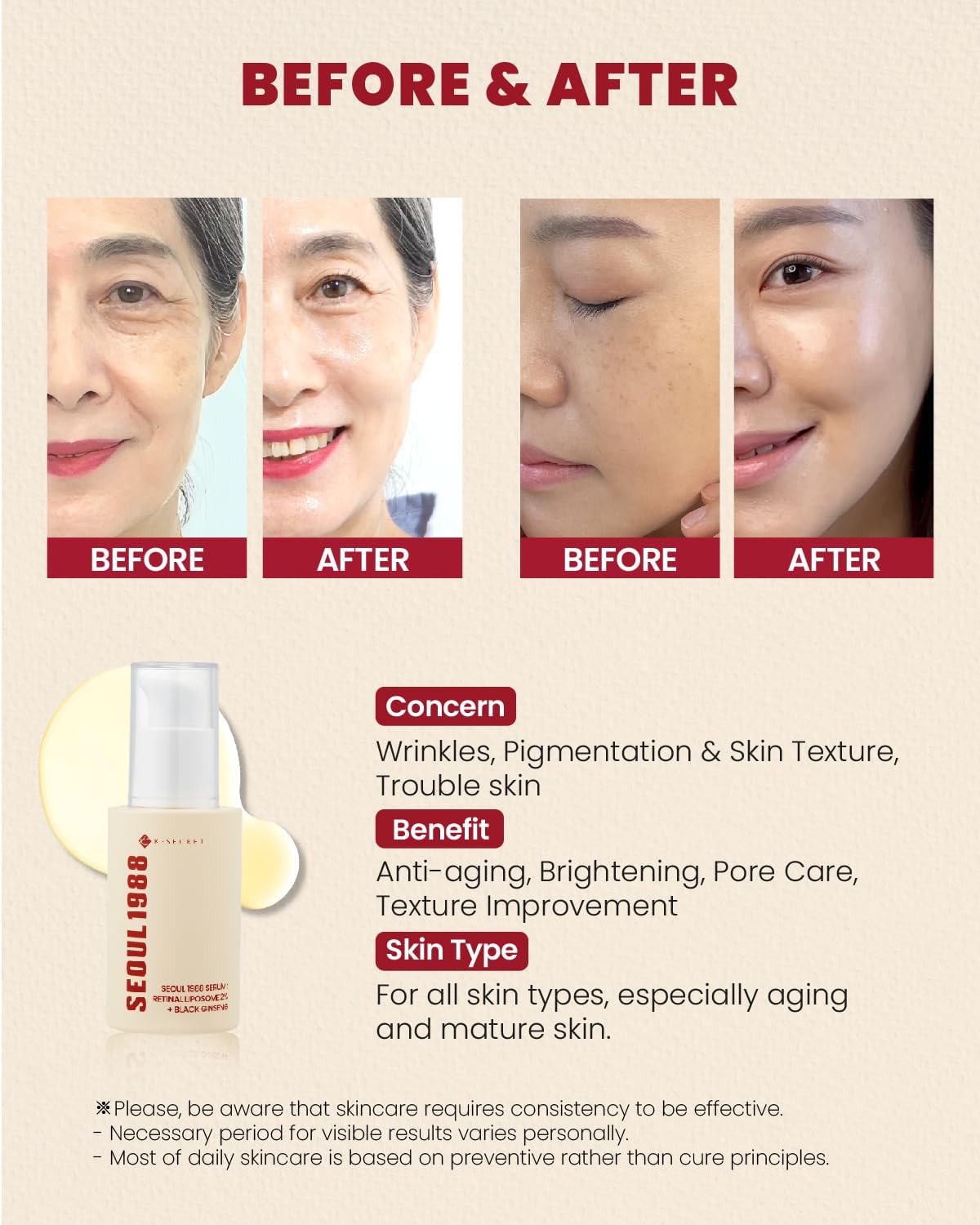 KSECRET SEOUL 1988 SERUM: RETINAL 2% + BLACK GINSENG