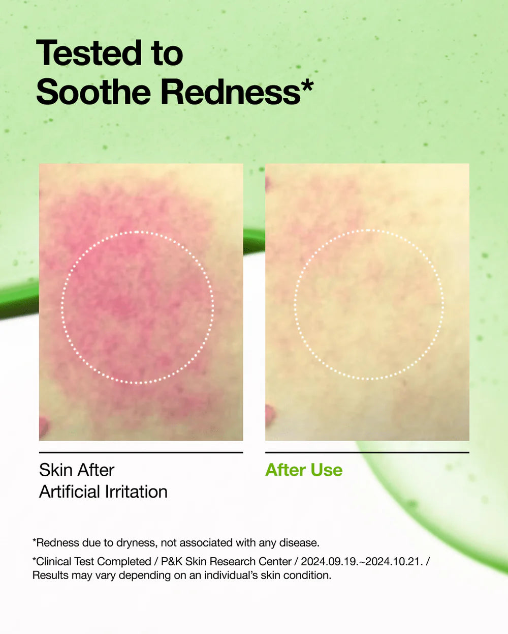 Anua - Azelaic Acid 10 Hyaluron Redness Soothing Serum