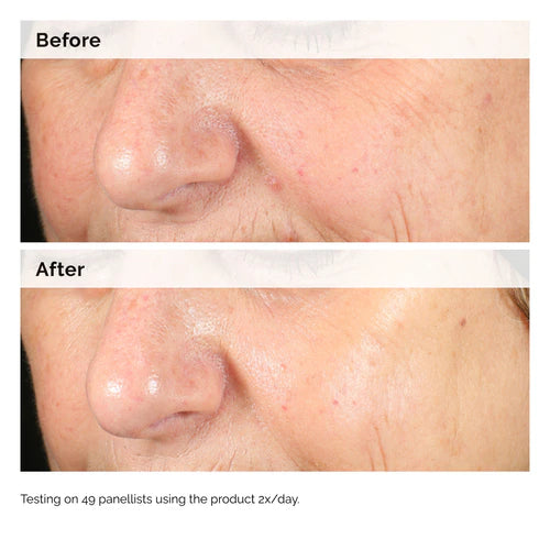 THE ORDINARY ALPHA ARBUTIN 2% + HYALURONIC ACID SERUM