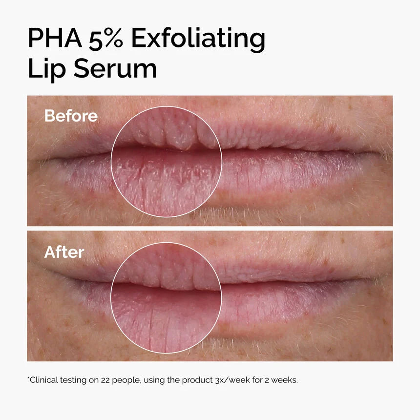 The ordinary Serum PHA 5% Exfoliating Lip Serum
